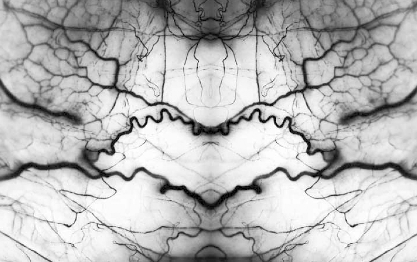 Harold E. Edgerton: Foto einer Retina (Netzhaut) mit Venen (hier gespiegelt)